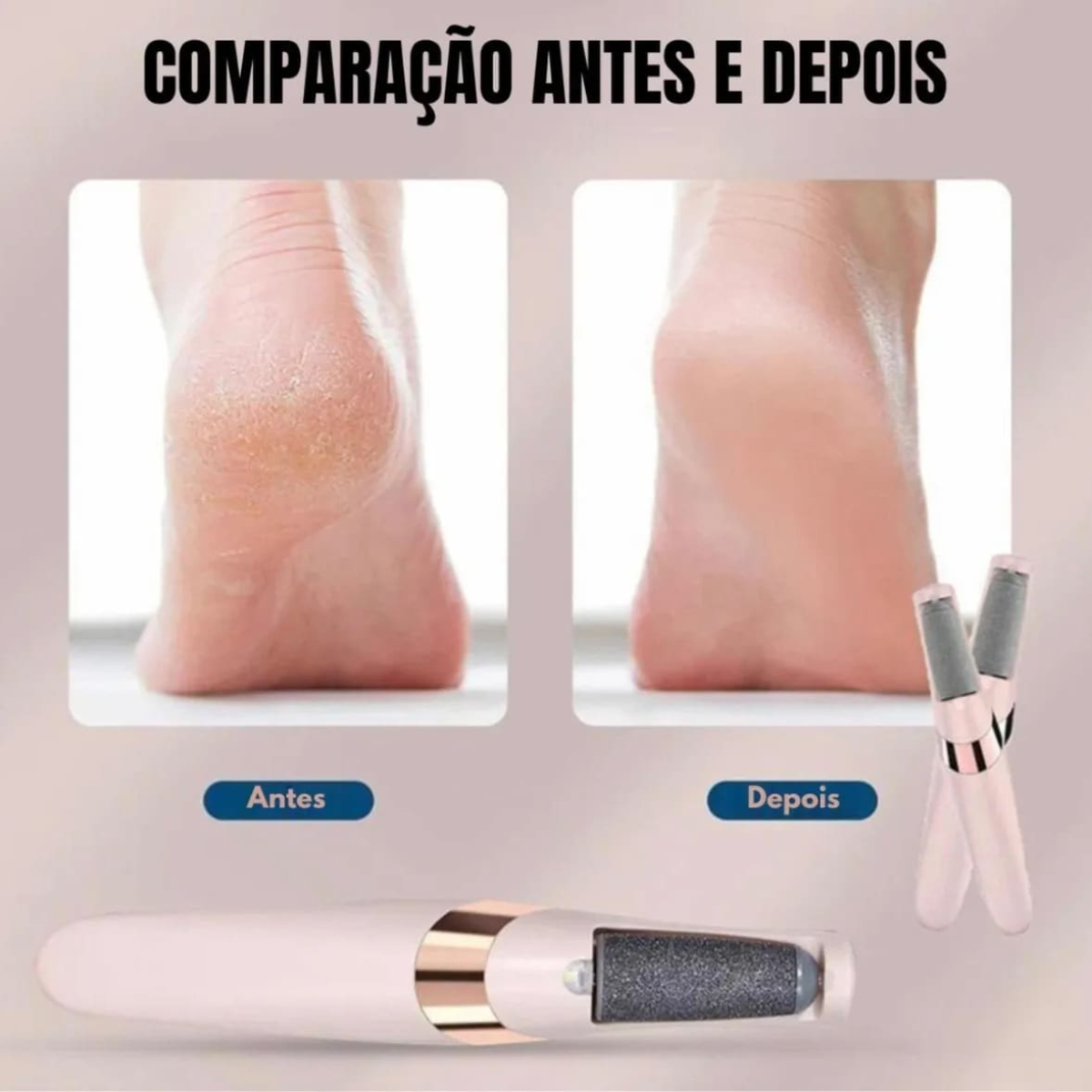 Lima Removedora de Callos Eléctrica para Pies Recargable