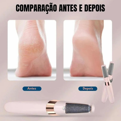 Lima Removedora de Callos Eléctrica para Pies Recargable